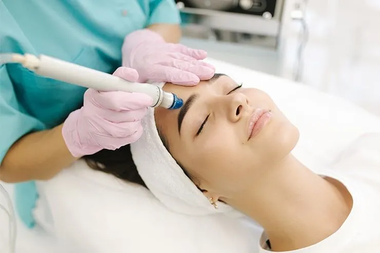 Microneedling facial near me